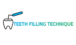 تقنية حشو الأسنان (teethfillingtechnique.com)